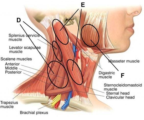 symptoms neck pain el paso tx.