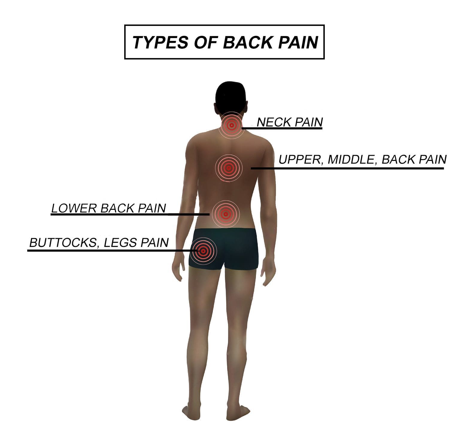 3 Strange Causes of Sciatica That Can Trigger Back Pain: Integrated Body  and Medicine: Integrated Medical Clinic