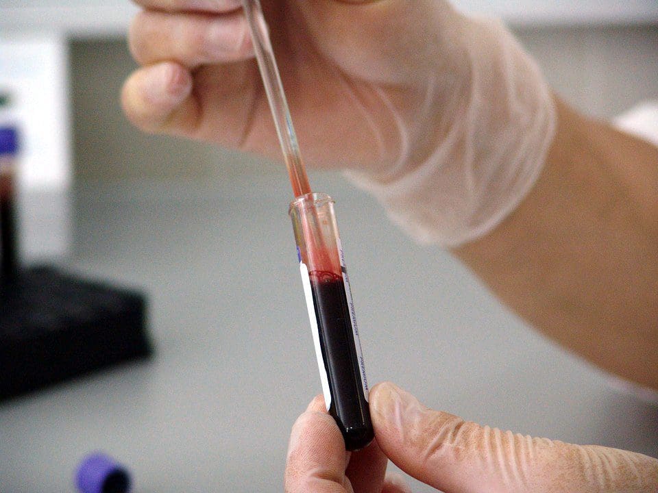 The Significance of Blood Tests for Diagnosing Back Pain