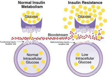 Insulin resistance