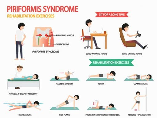 https://dralexjimenez.com/wp-content/uploads/2018/01/piriformis-syndrome-rehabilitation-exercises-510x382.jpg