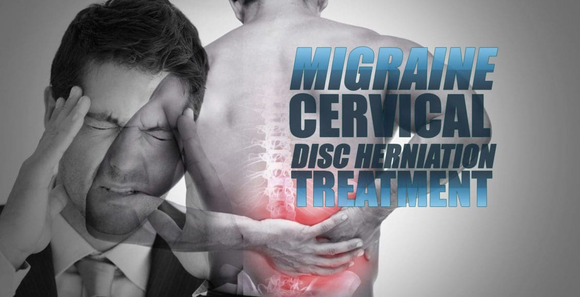 Tratamiento de migraña y hernia de disco cervical en El Paso, TX Quiropráctico