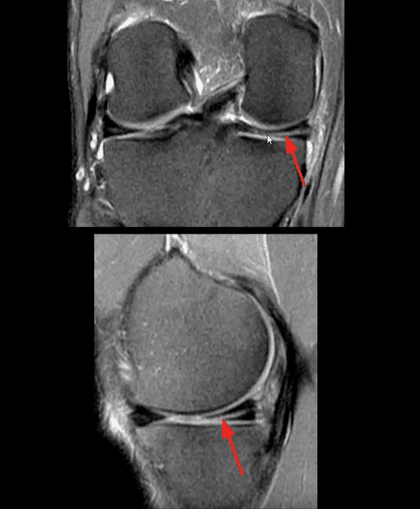 knee pain acute trauma el paso tx.