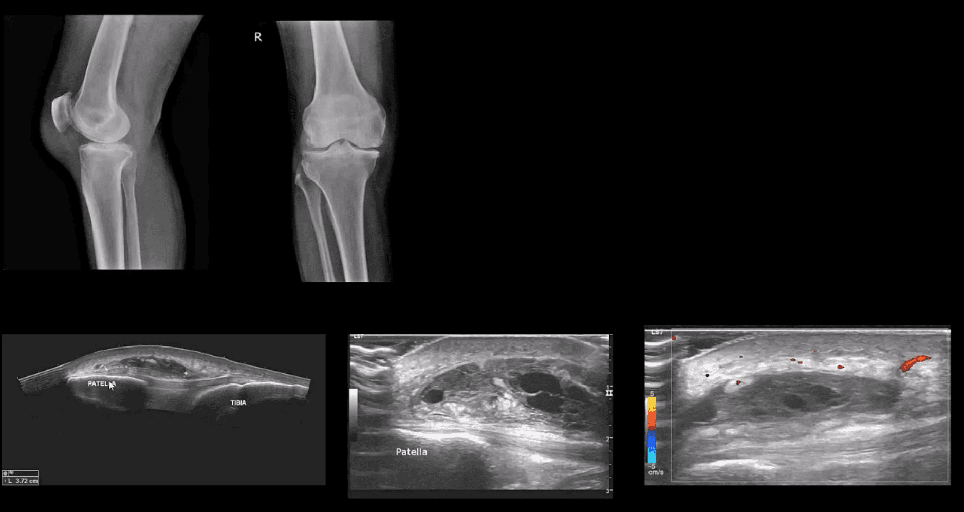 knee pain acute trauma el paso tx.