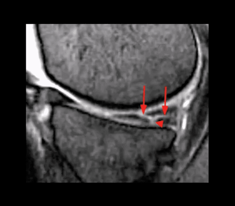 knee pain acute trauma el paso tx.