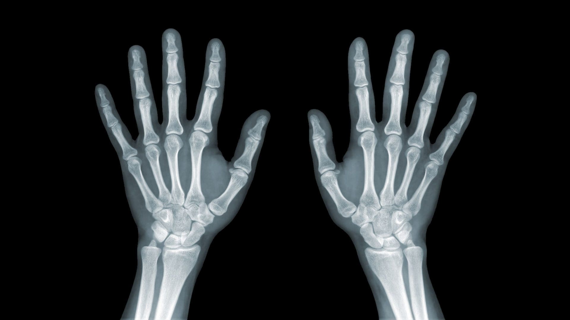 wrist hand diagnostic imaging el paso tx.