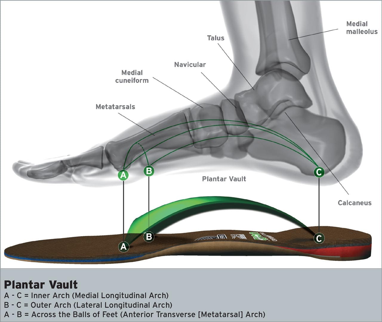 A Guide to Treating Plantar Fasciitis with Acupuncture