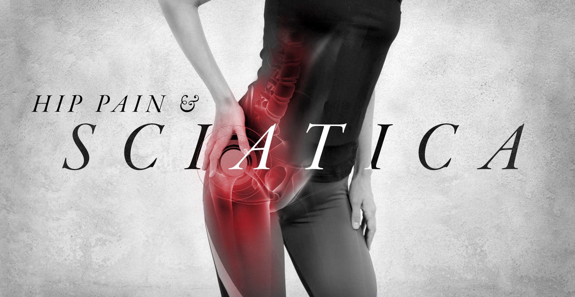 Hip Pain and Sciatica - Complete Orthopedics
