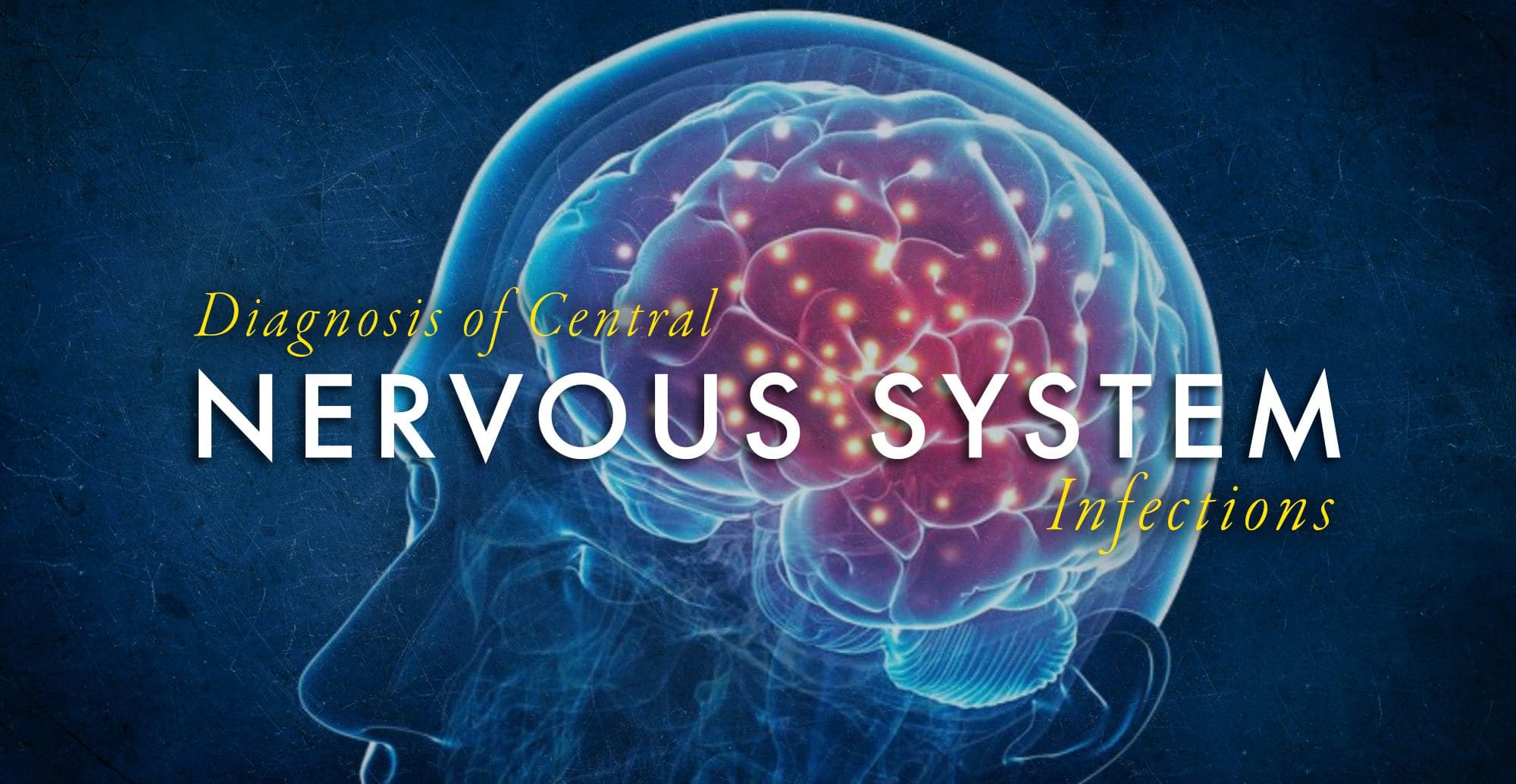 Imagen que demuestra el cerebro humano para el diagnóstico de infecciones del sistema nervioso central.