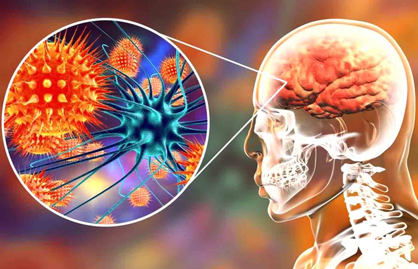 Functional Neurology: Understanding Autoimmune Brain Disease Blog Post | El Paso, TX Chiropractor