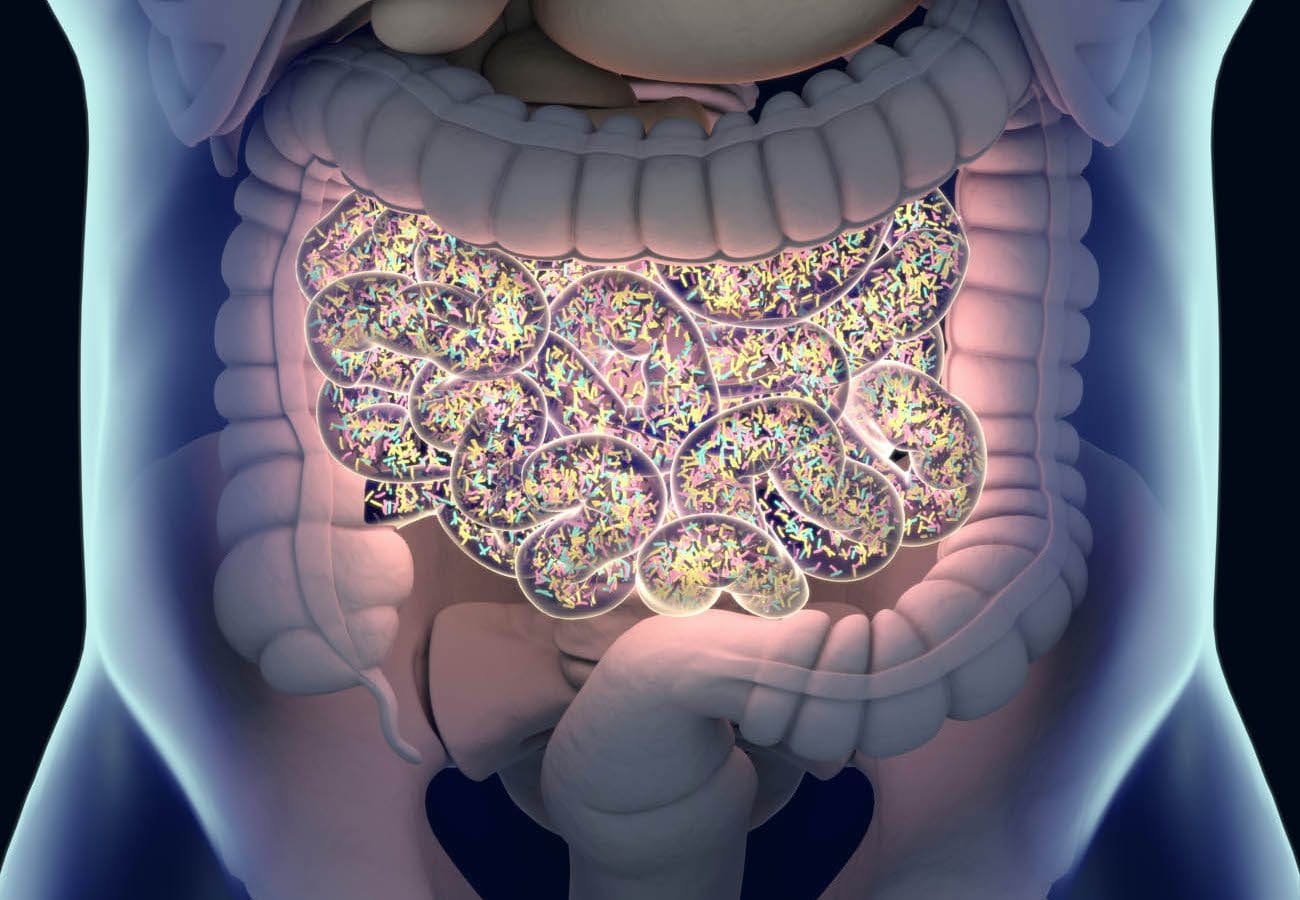 Image showing SIBO or small intestinal bacterial overgrowth.