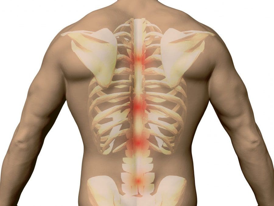 Trastornos de la columna vertebral