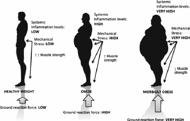 What Causes Lower Back Fat