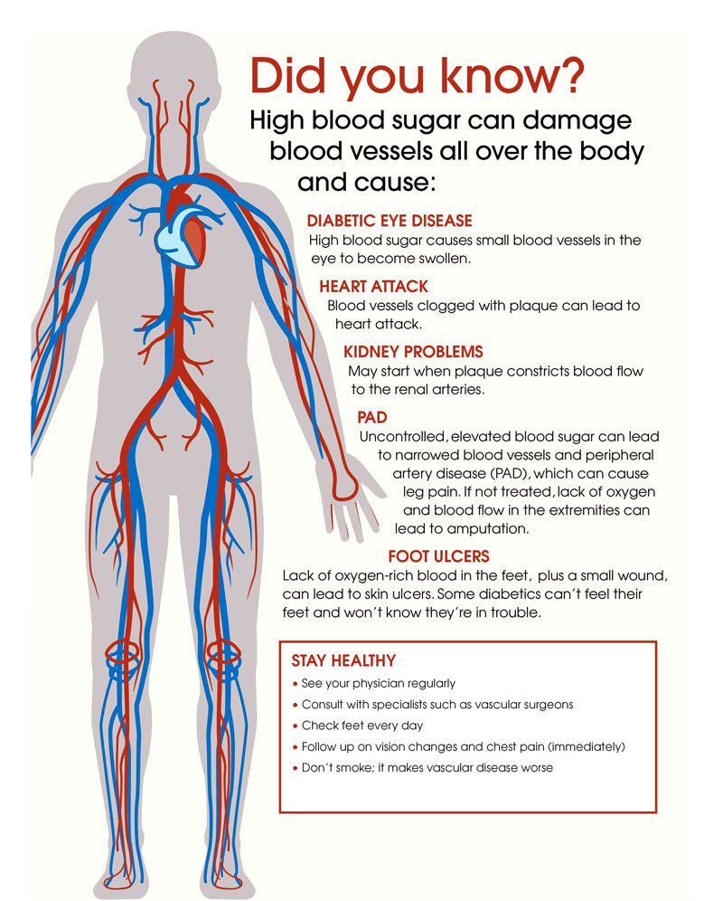 5 Ways to Increase Blood Flow to Reduce Back Pain: Pinnacle Pain