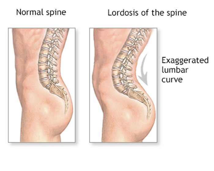 Why is lower stomach fat and lower back fat the slowest parts to