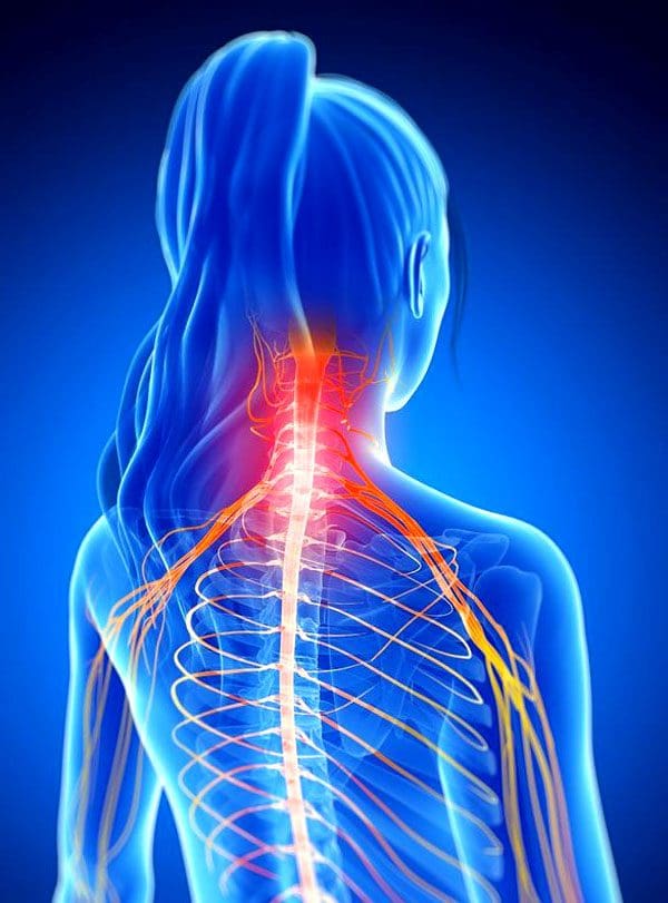 11860 Vista Del Sol, Ste. 128 Movilización quiropráctica para articulaciones cervicales con radiculopatía