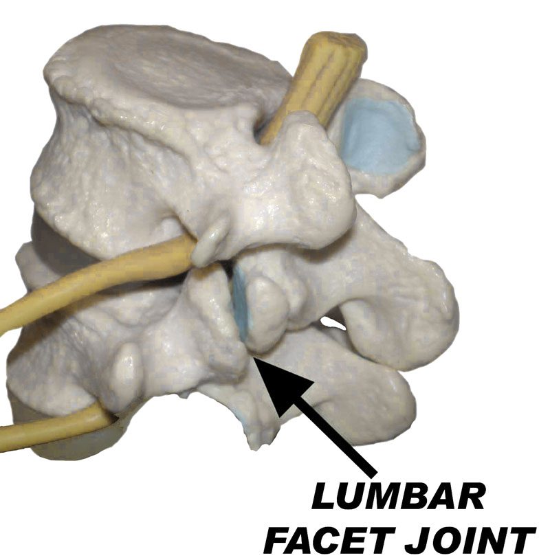 Chiropractic Care for Effective Rheumatoid Arthritis Relief