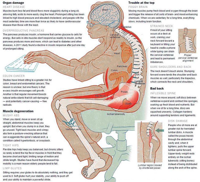 Poor posture linked to decreased lifespan.