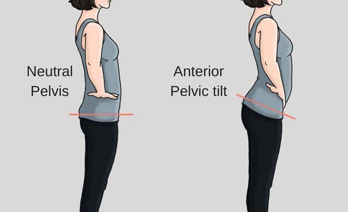 Rounded Shoulders Functional Chiropractic Wellness