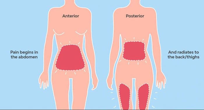 why-does-my-back-teeth-hurt-when-i-eat-something-sweet-printable