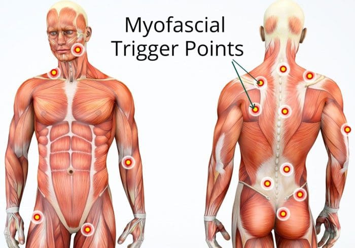 11860 Vista Del Sol, Ste. 128 nudos musculares de la espalda baja se pueden descomponer con quiropráctica