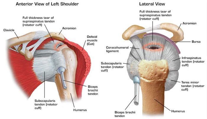 Rotator Cuff мышца