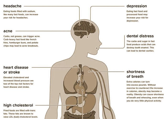 Dolore cronico e abitudini alimentari