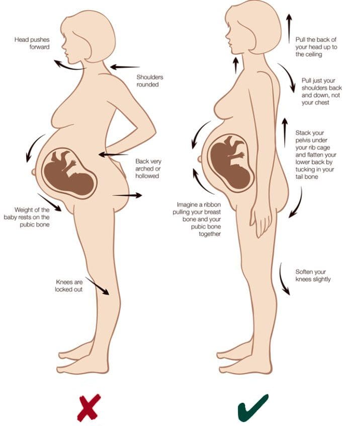 Embarazo saludable con tratamiento quiropráctico