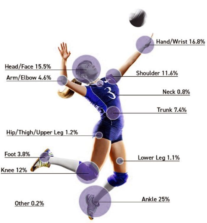 Infortuni da pallavolo: trattamento chiropratico e riabilitazione