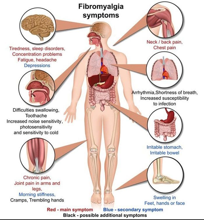 Fibromyalgia Pêvajoya Têgihîştina Painşê Guherandî