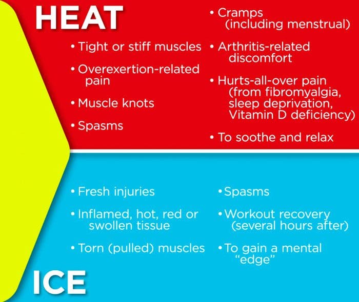 Usar calor y hielo para un nervio pinzado