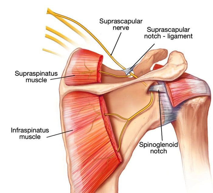 Pulled Shoulder Muscle