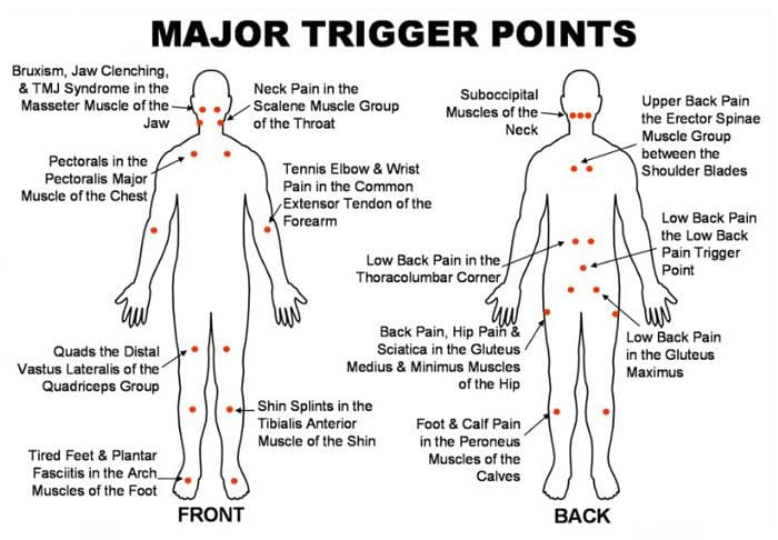 Masaje neuromuscular para el dolor muscular