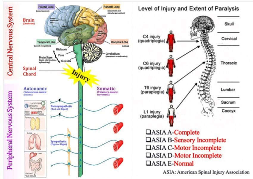 NonTraumatic Spinal Cord Injury