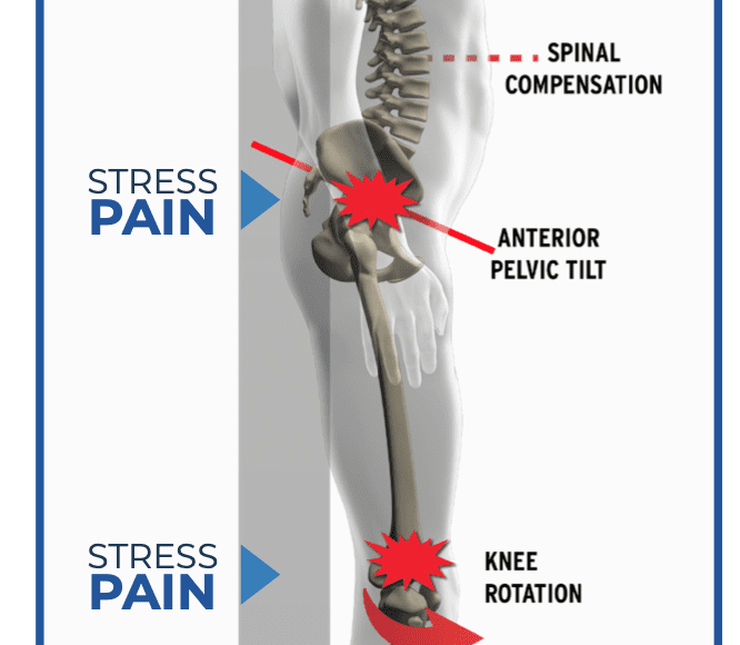 Estrés y dolor relacionados con la columna