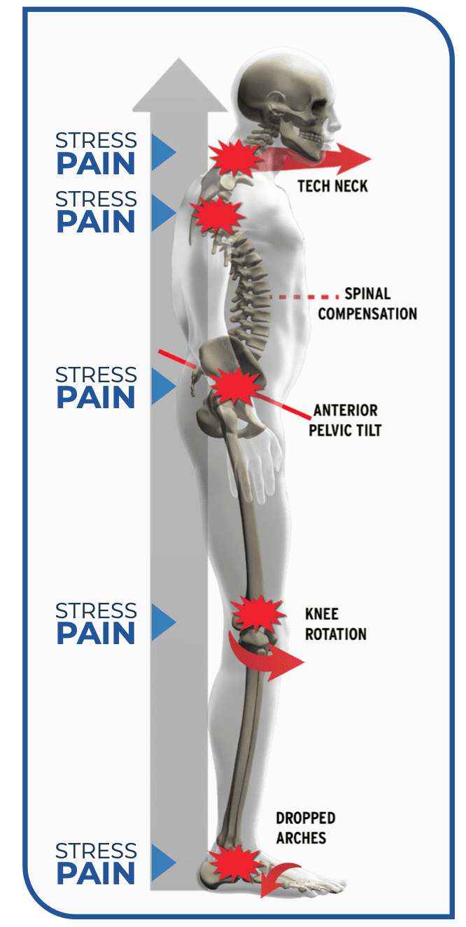 Estrés y dolor relacionados con la columna