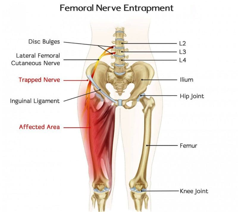 Nerve Injury