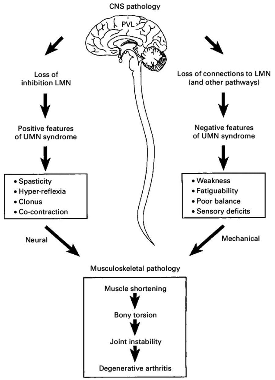 Horumarinta Neuromusculoskeletal