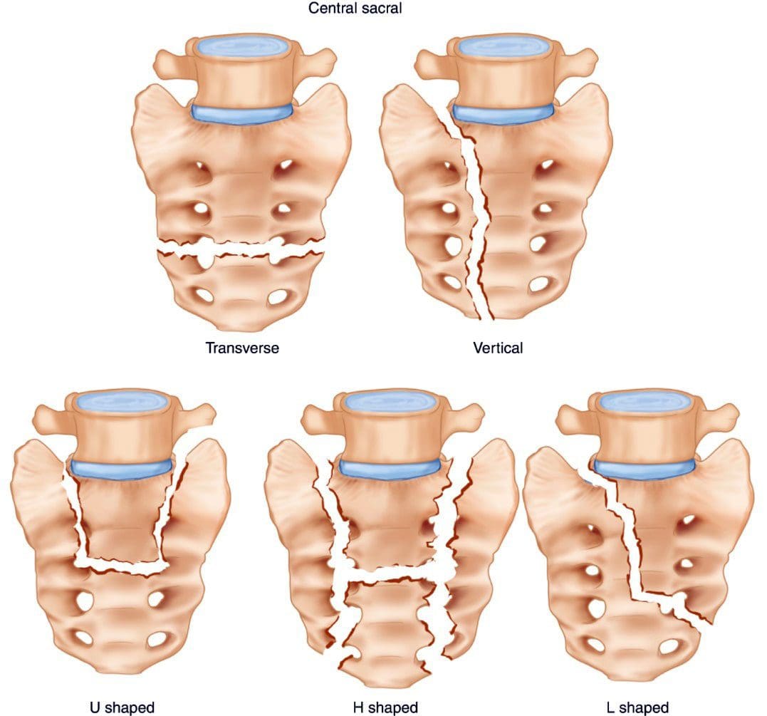 Healthy Street - WHAT'S UNDER THE SACRUM? The sacrum is a large