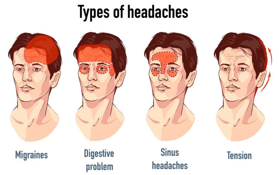 most-common-form-of-pain-the-headache