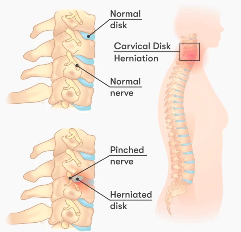 Nerve Healing Signs - El TX Doctor Of