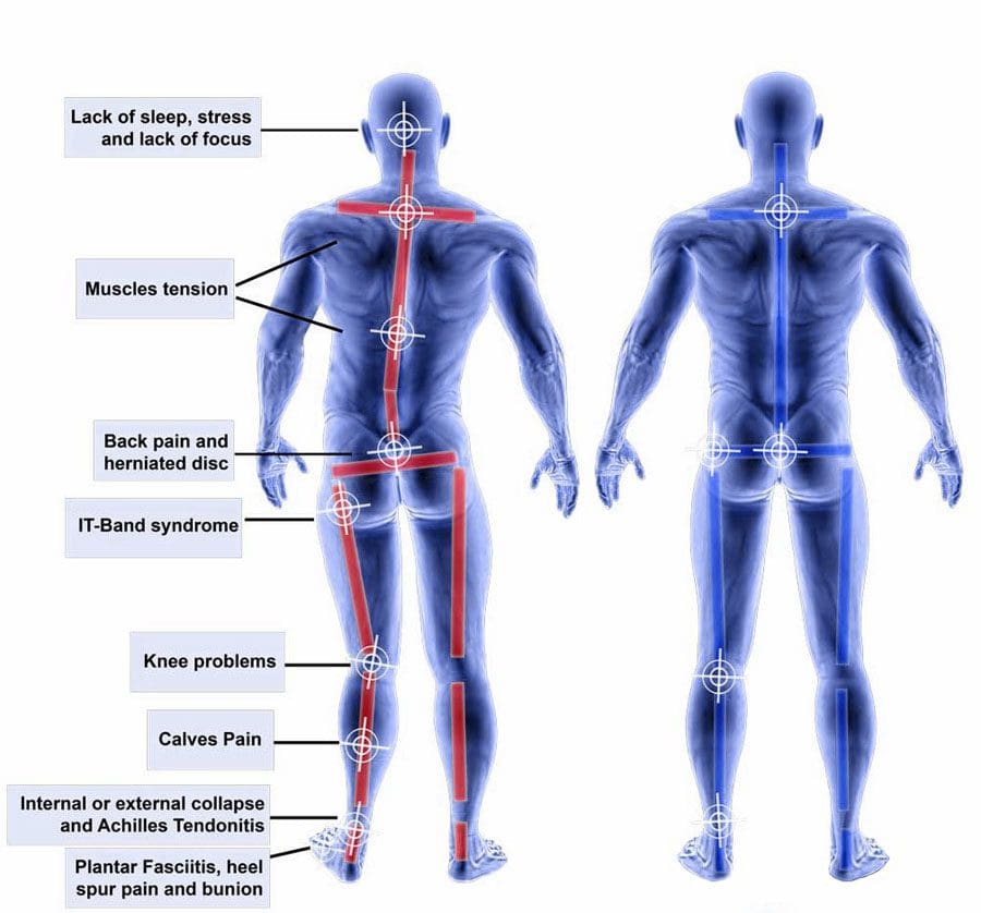 Misaligned Uneven Shoulders Chiropractor