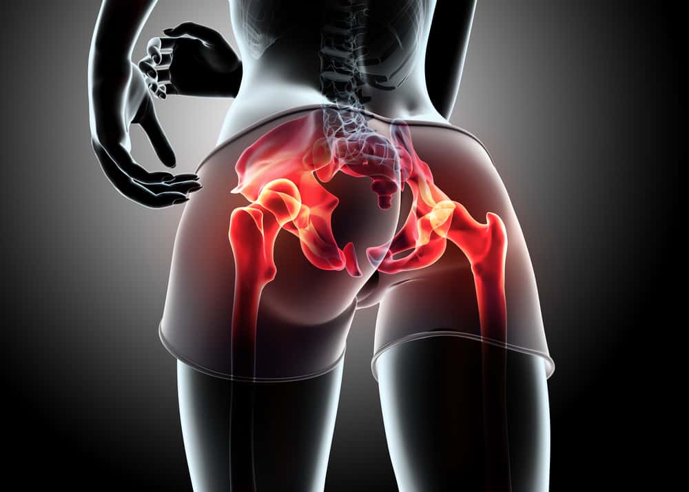 Can Chiropractic Relieve the Piriformis Syndrome?