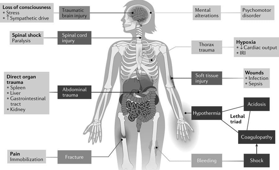 Riabilitazione chiropratica da danno d'organo interno