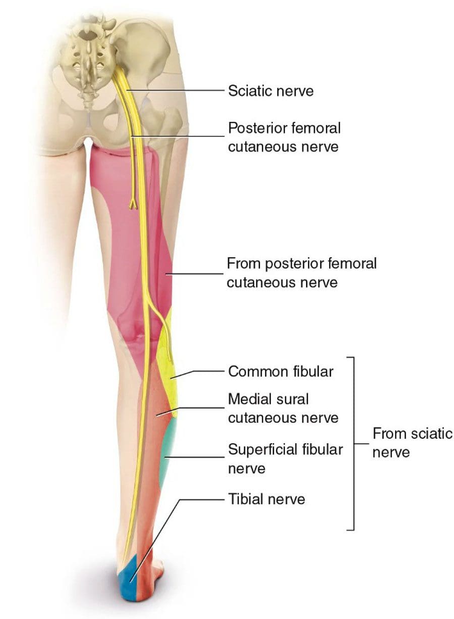 Il dolore alla sciatica può irradiarsi al ginocchio: lesione medica chiropratica