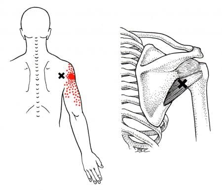 The Teres Minor Muscle Affected By Trigger Points - El Paso, TX