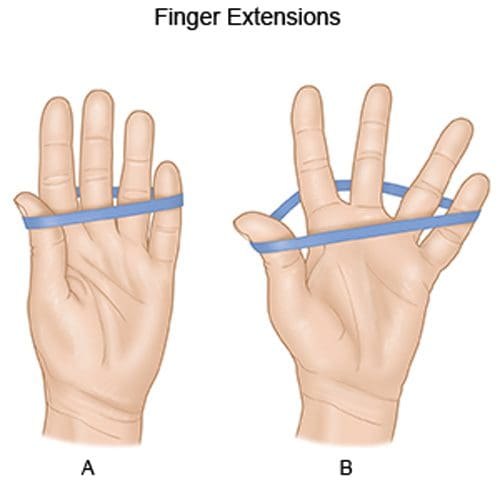 Rubber band finger extensions sale