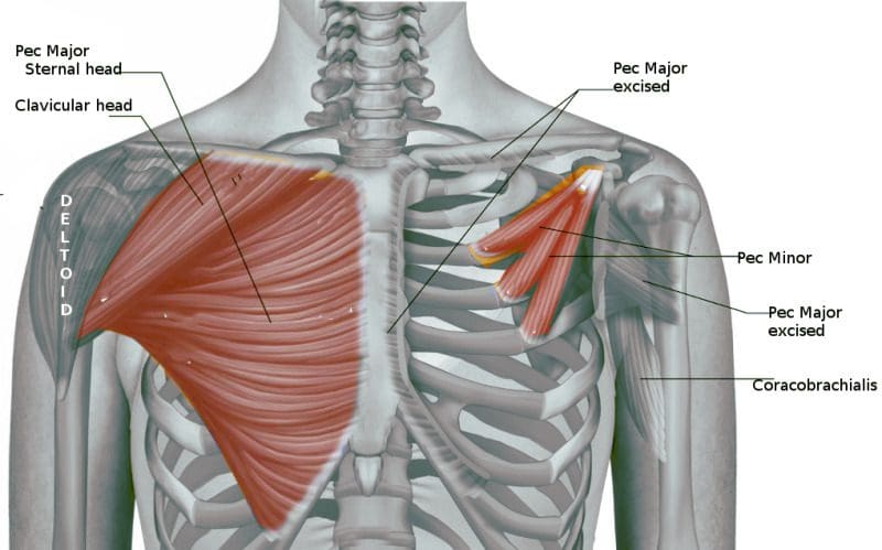 The Pectoralis Minor Being Affected By Myofascial Pain - El Paso, TX ...