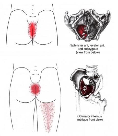 bulbospongiosus trigger points