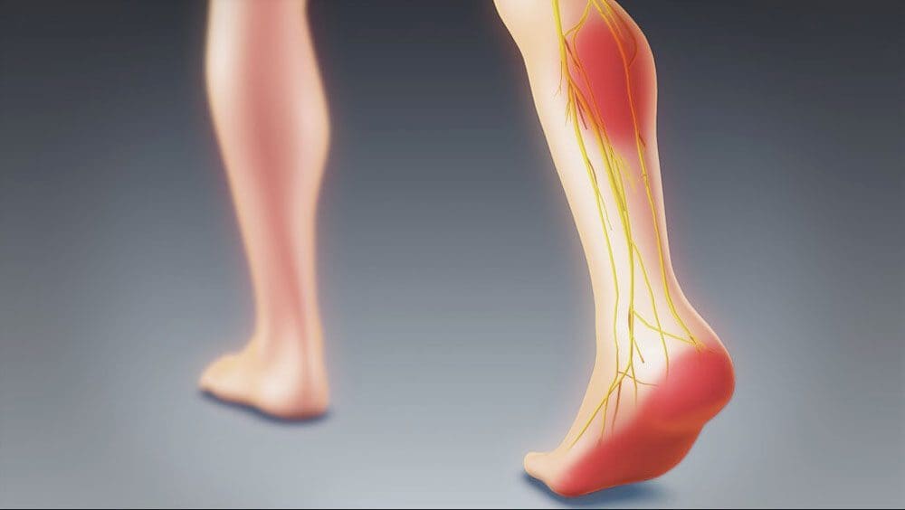 Sciatica Foot and Ankle Issues: Manua Fomai Chiropractic